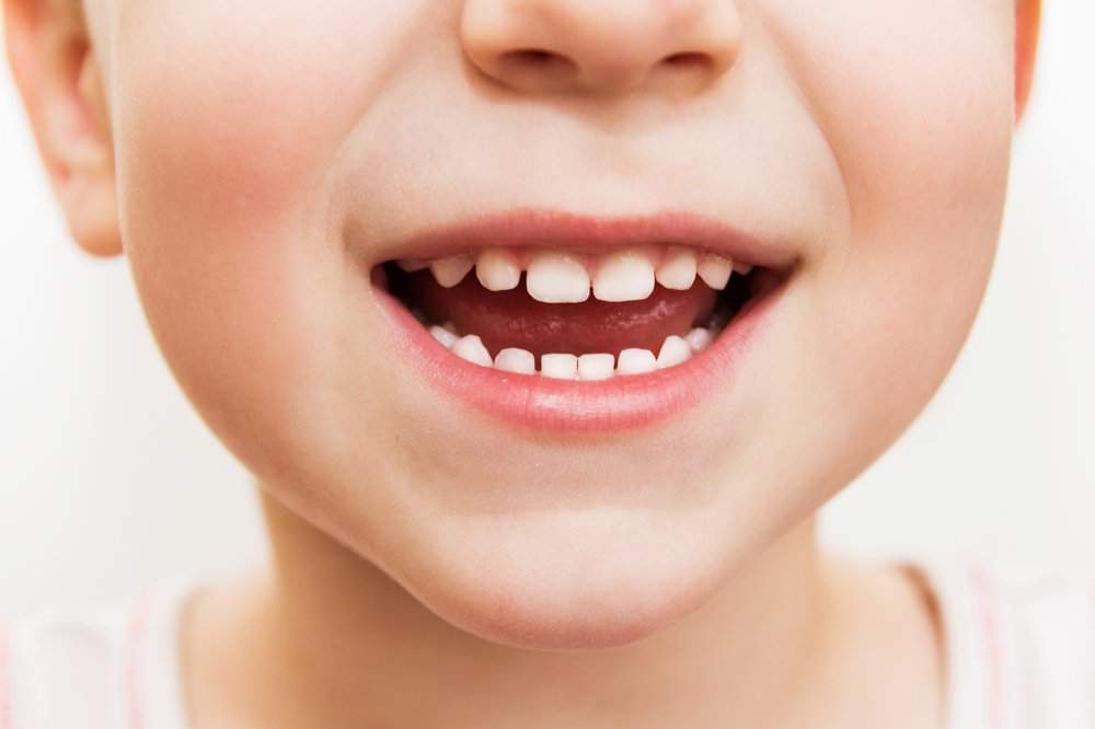Child dental benefit scheme